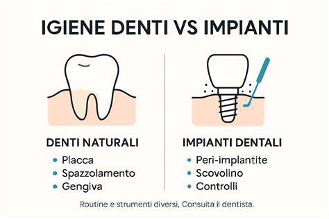 infografica igiene dentale come funziona