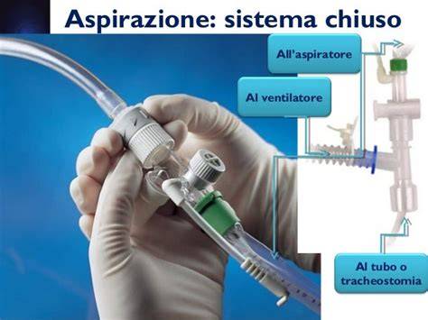 schema di aspirazione tracheale e componenti principali