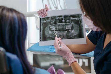 tecnologie IA radiografie dentali