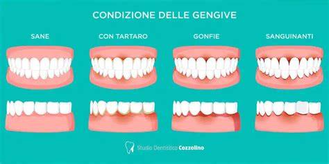 gengive infiammate-infografica