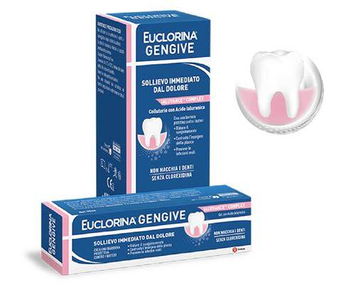 schema gengive e condizioni