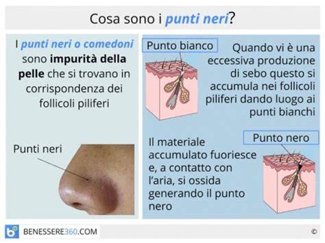 diagramma confronto punti neri e bianchi