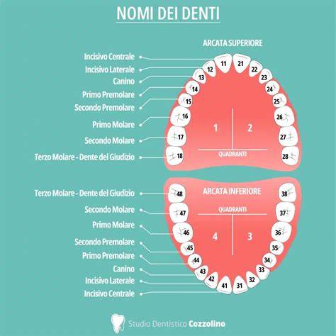 apparecchi dentali tipi grafico (8 words)