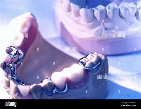 comparazione cubas metalliche odontoiatria