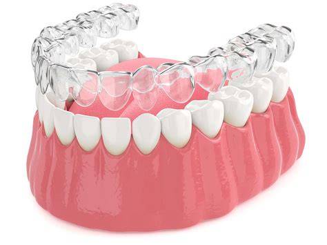 allineatori dentali fondamenti e impatti