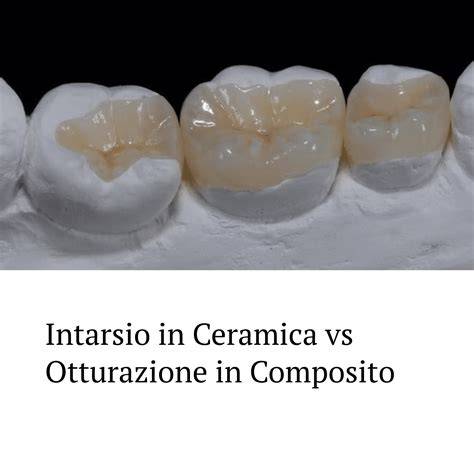 ceramica vs composito confronto restauro