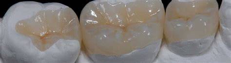 durata intarsio ceramica e composito