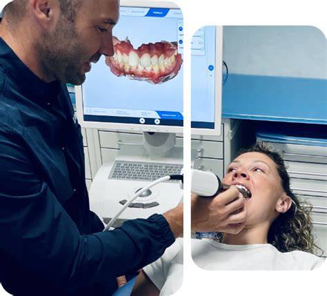 workflow di scanner intraorale in studio dentistico