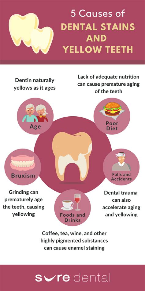 causes of tooth stains infographic
