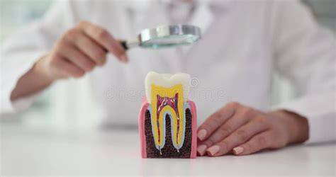 dentist examining tooth plaque