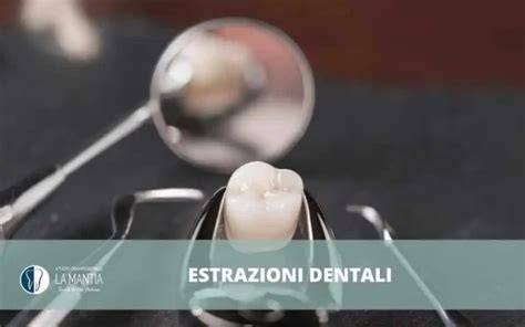grafico miti estrazioni dentali percentuali