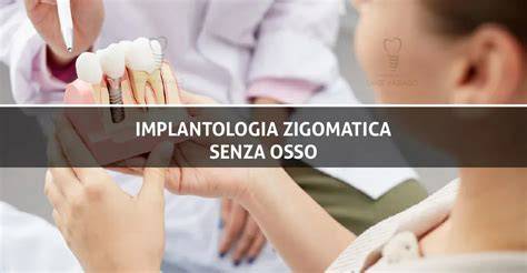 implantologia zigomatica concetti e applicazioni